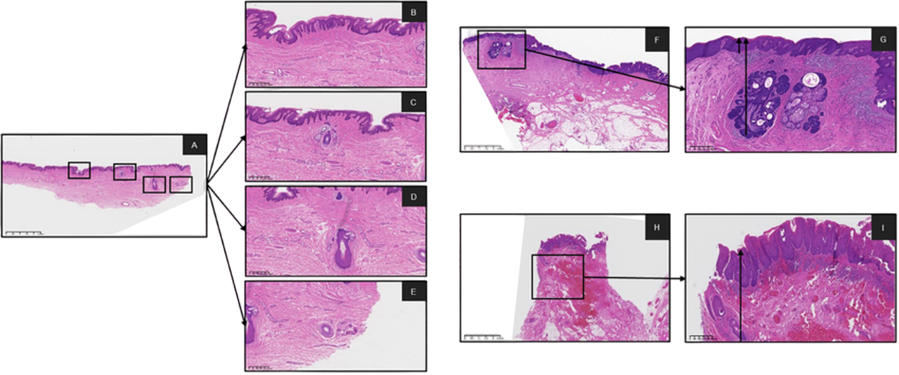 Visores KFBio SmartView